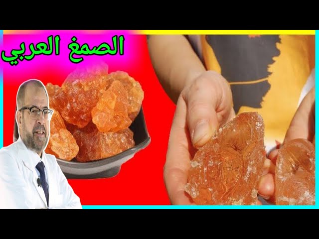 الصمغ العربي