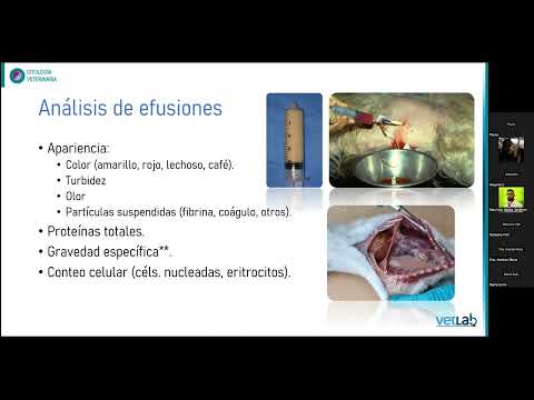 Citología de líquidos: Generalidades e importancia en la clínica diaria
