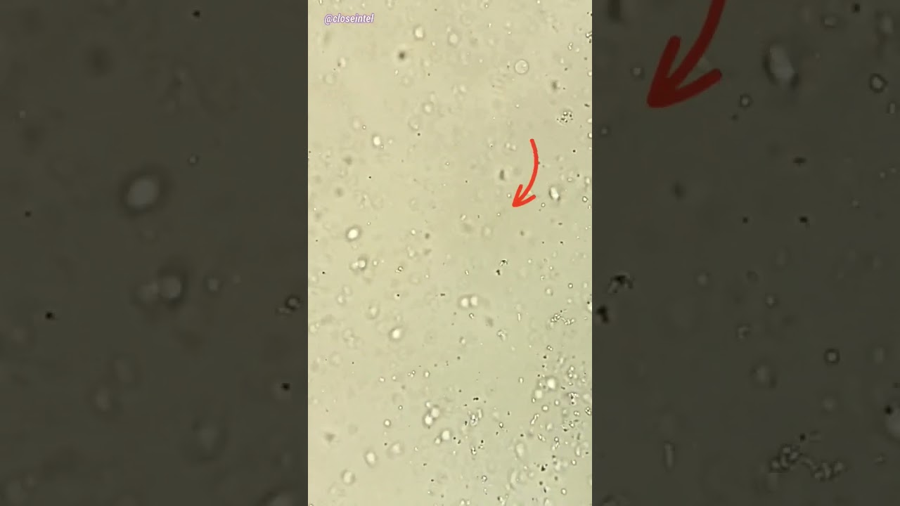 Raw Eggs Under Microscope (Chicken Egg)