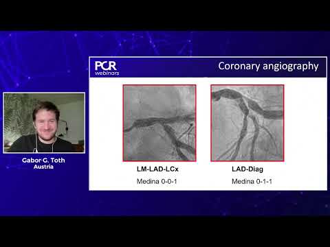 DCB PCI in clinical practice: negotiating the learning curve - Webinar