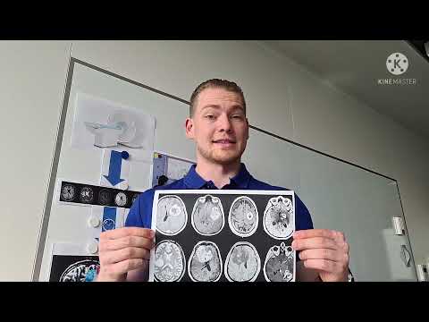 Daniel Krahulec: Diffusion MRI-based planning of oncological neurosurgery