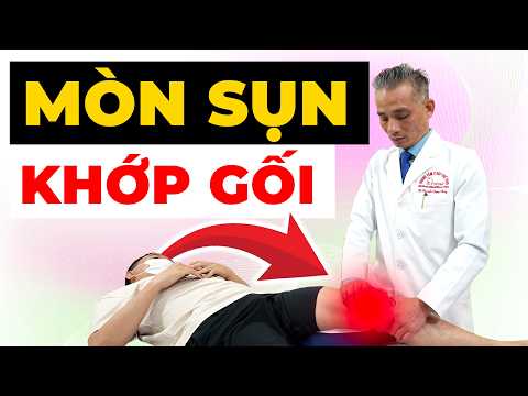Mòn hết sụn khớp gối có cần phẫu thuật? Sự thật khiến nhiều người bất ngờ!