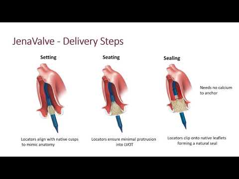TAVI in Aortic Regurgitation