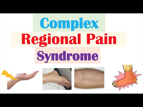 Complex Regional Pain Syndrome | Causes, Pathophysiology, Signs & Symptoms, Diagnosis, Treatment