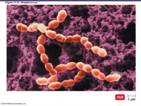 Ch 11 Gram Positive Bacteria and Archaea