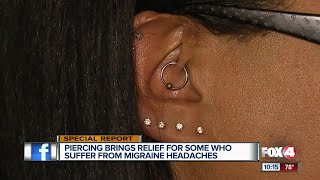 Using a piercing to get rid of migraine pain