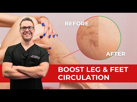 Heel Spurs Plantar Fasciitis BEST Home Treatment 2022