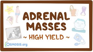 Adrenal masses: Pathology review