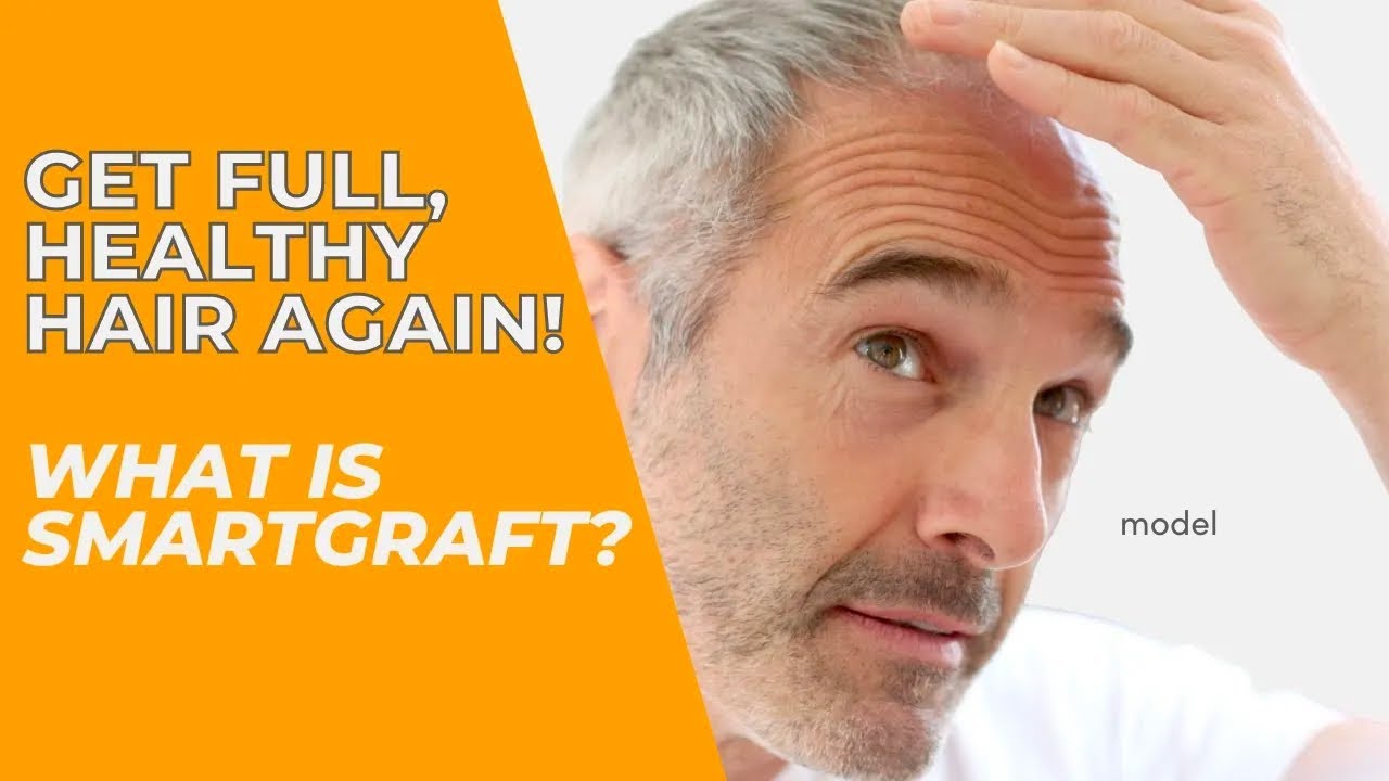 SmartGraft: Not Your Grandpa’s (or Grandma’s) Hair Plugs