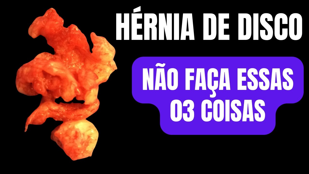 03 Coisas que quem tem Hérnia de Disco NÃO deveria fazer