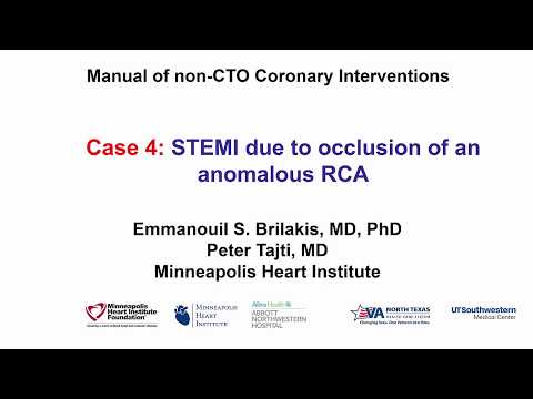 Case 4: PCI Manual - STEMI in anomalous RCA