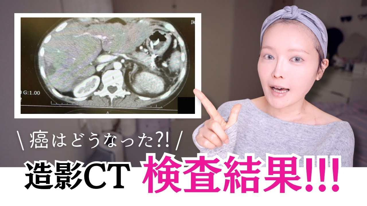 【検査結果】半年ぶりのCT、癌はどうなっていたか？…そして1月後半、また救急搬送された今の状態。