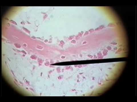 Slide 33 - Developing Bone