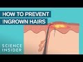 What Are Ingrown Hairs — And How To Treat Them