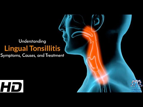 All About Allergy Shots