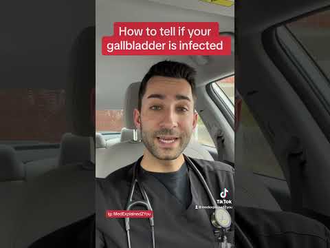 Who’s got a gallbladder? #shorts