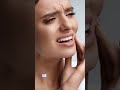 Aparat Dentar Spark Aliniere Fără Durere Excedent Aparatdentar Estetica Zambet Spark