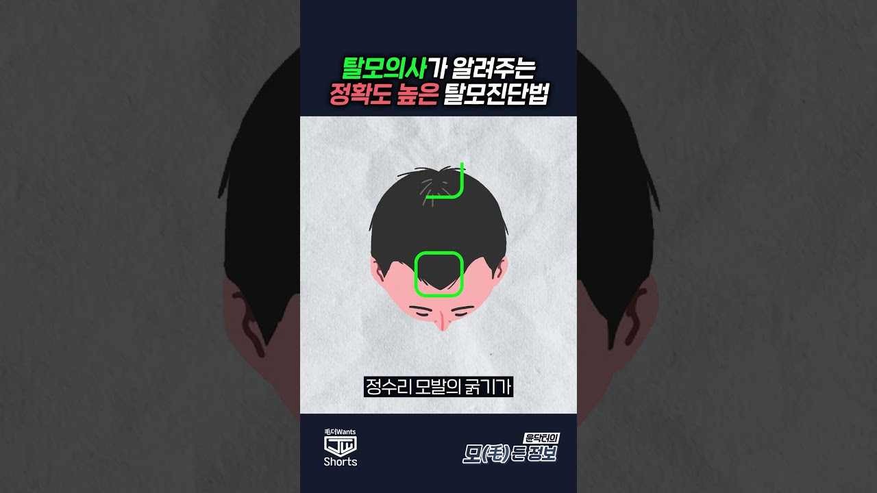 더원츠의원 숏폼