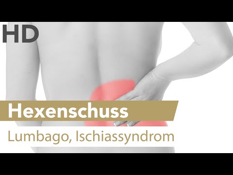 5 Phiolen Osteochondrose Wie viel ist ein chirurgischer Eingriff am Hüftgelenk in Belarus