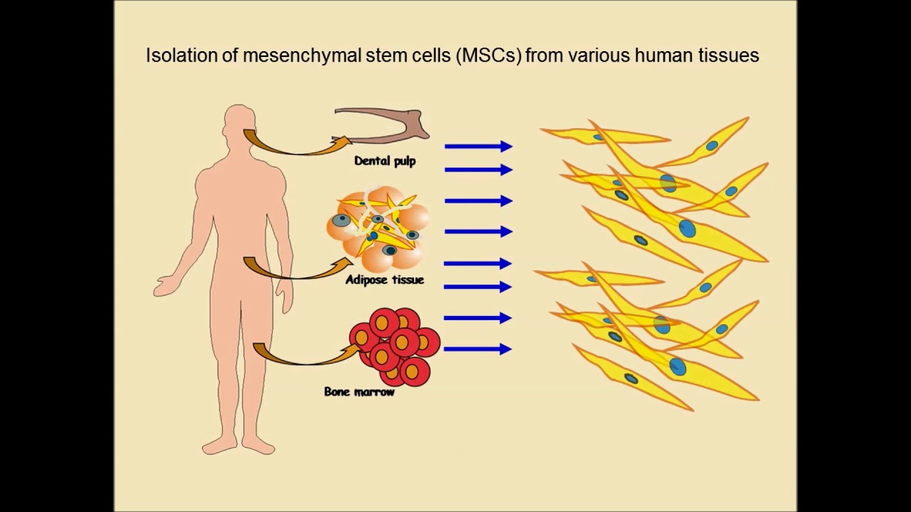 MSC iron oxide exosomes for cancer therapy – Video abstract [ID 145096]