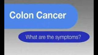Colon cancer symptoms and information