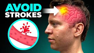 This Mineral Deficiency Is Causing Strokes