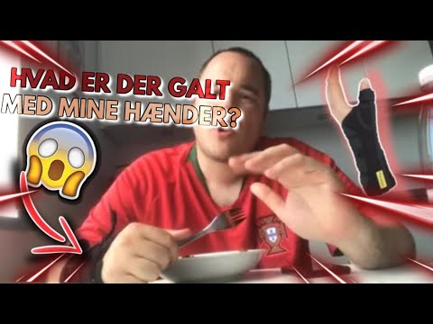 HVAD ER DER GALT MED MINE HÆNDER ?