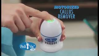 صنفرة القدم