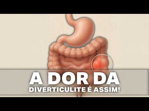 What is diverticulitis pain like and when should you seek medical help?