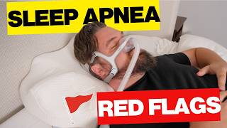 How to Tell If You Have Sleep Apnea (Without a Sleep Study)
