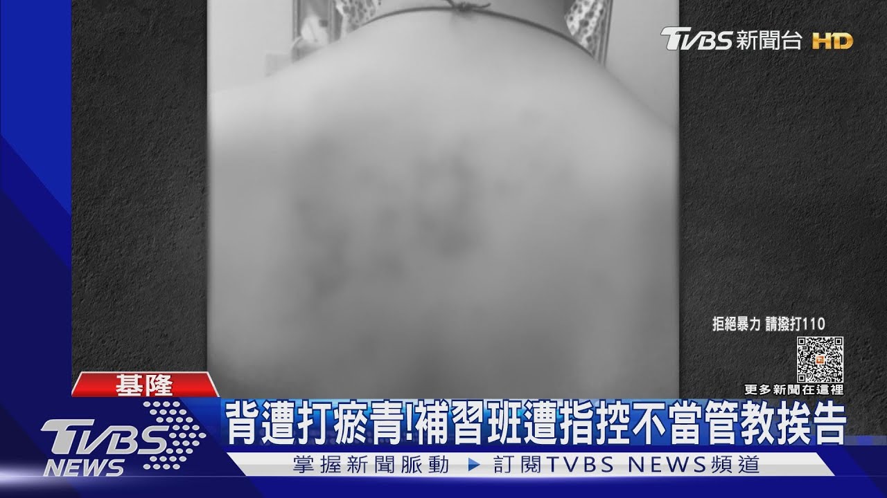 背遭打瘀青! 補習班遭指控不當管教挨告