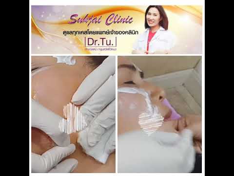 ร้อยไหม หน้าเรียว
