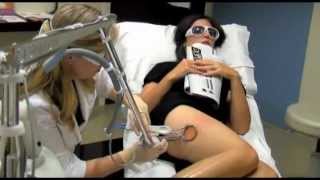 preview picture of video 'Spider Vein Treatments | Worthington Ohio'