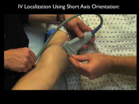 How to: Peripheral Venous Access Under Ultrasound Guidance Case Study Part 2