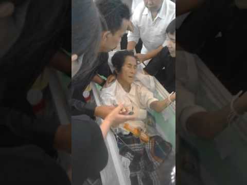 โรคสะเก็ดเงินเป็นอวัยวะภายในอะไร อาการหนังศีรษะโรคสะเก็ดเงินและการรักษา