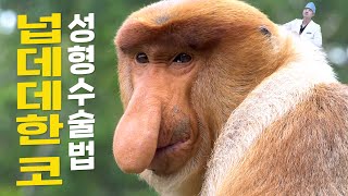 크고 넙적한 코 성형수술로 해결할할수 있을까? 콤플렉스별 코성형