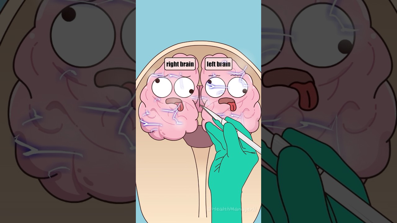 Is the treatment for epilepsy actually cutting open the brain?#shorts #funny #hot