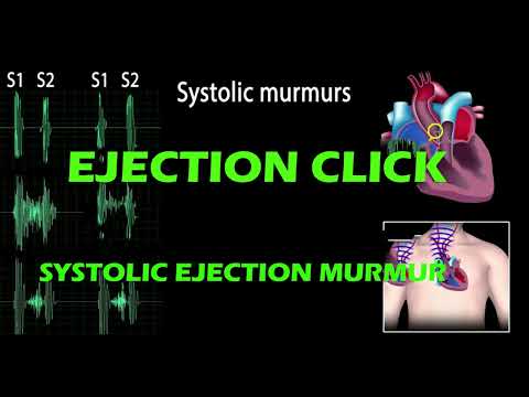 Ejection Click And Systolic Ejection Murmur pf Heart Sound