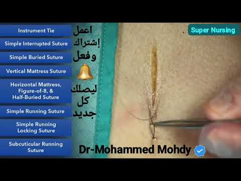 Simple Running Locking Suture - Learn Suture Techniques تابع سلسلة تعلم الغرز الجراحية