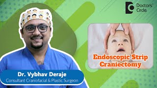 Endoscopic Strip Craniectomy &amp; Helmet Therapy #craniosynostosis - Dr. Vybhav Deraje| Doctors&#39; Circle