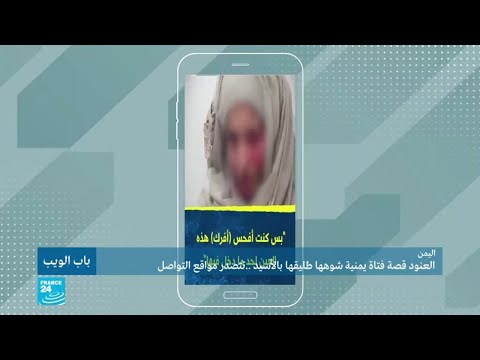 العنود.. قصة فتاة يمنية شوهها طليقها بالحمض تتصدر مواقع التواصل