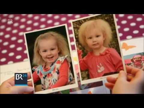 Abendschau vom 29.12.2016: Struwwelpeter-Gen entdeckt | BR24