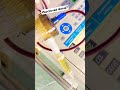Removal Of Plasma From Blood Procedure Name? #nephrology #uvteam #dialysis #ndt #plasmapheresis #abo