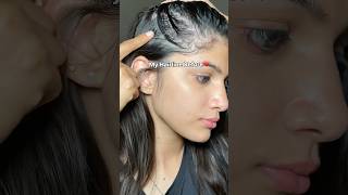 Download lagu I was going Bald 😭 but this saved my hair ✨ #hairthinning #hairfall #hairgrowthserum #haircare mp3 Download lagu I was going Bald 😭 but this saved my hair ✨ #hairthinning #hairfall #hairgrowthserum #haircare mp3