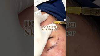 Download lagu DNA Salmon Skin Booster, solusi buat kamu yang ingin kulit lembab dan bebas kerutan halus mp3