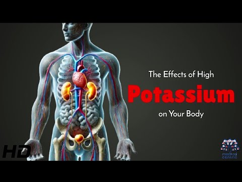 Hyperkalemia Explained: The Dangers of High Potassium Levels