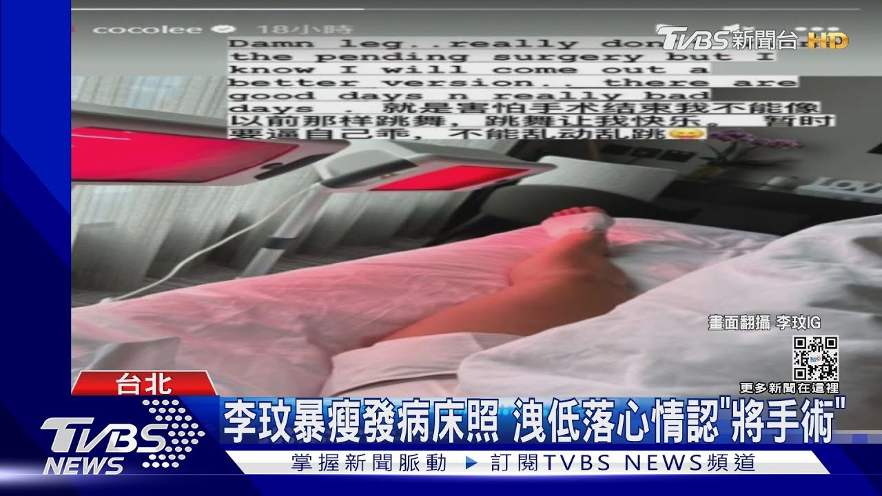 才傳婚變! 李玟暴瘦PO照認「腳將動刀」嘆:怕不能跳舞