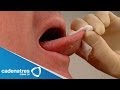 ¿Cómo detectar si hay cáncer bucal? ¿Cómo detectar si hay cáncer bucal?