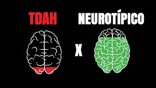 How the Brain Works in People with ADHD