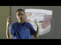 Effect of Frankel Regulator on Teeth Alignment & Bone During Orthodontic Treatment by Dr Mike Mew